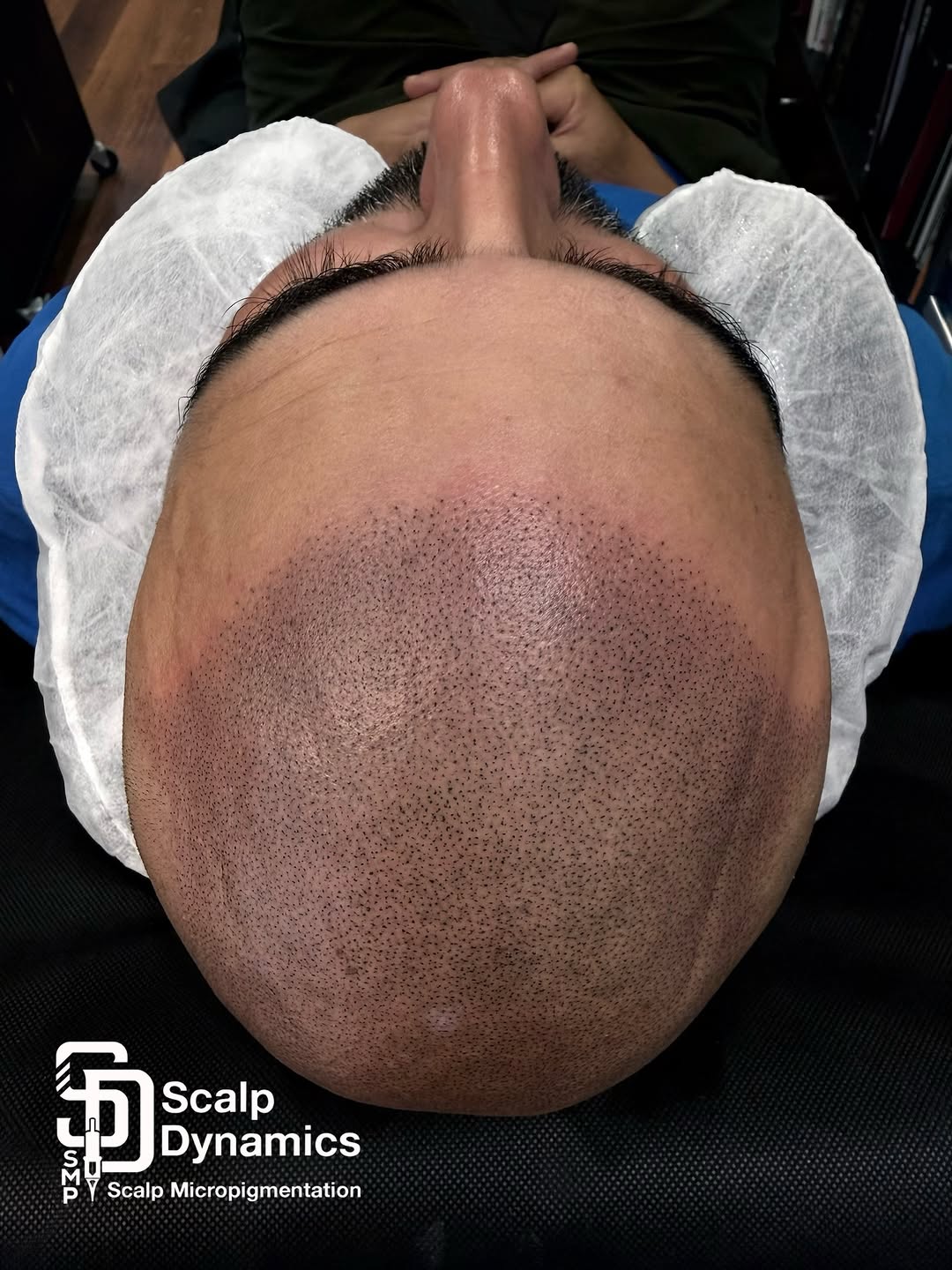 ScalpDynamics tattoo 13