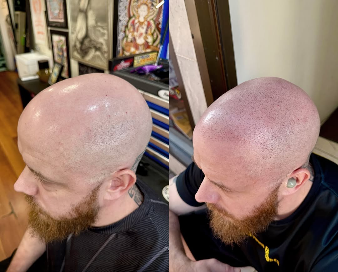 ScalpDynamics tattoo 19