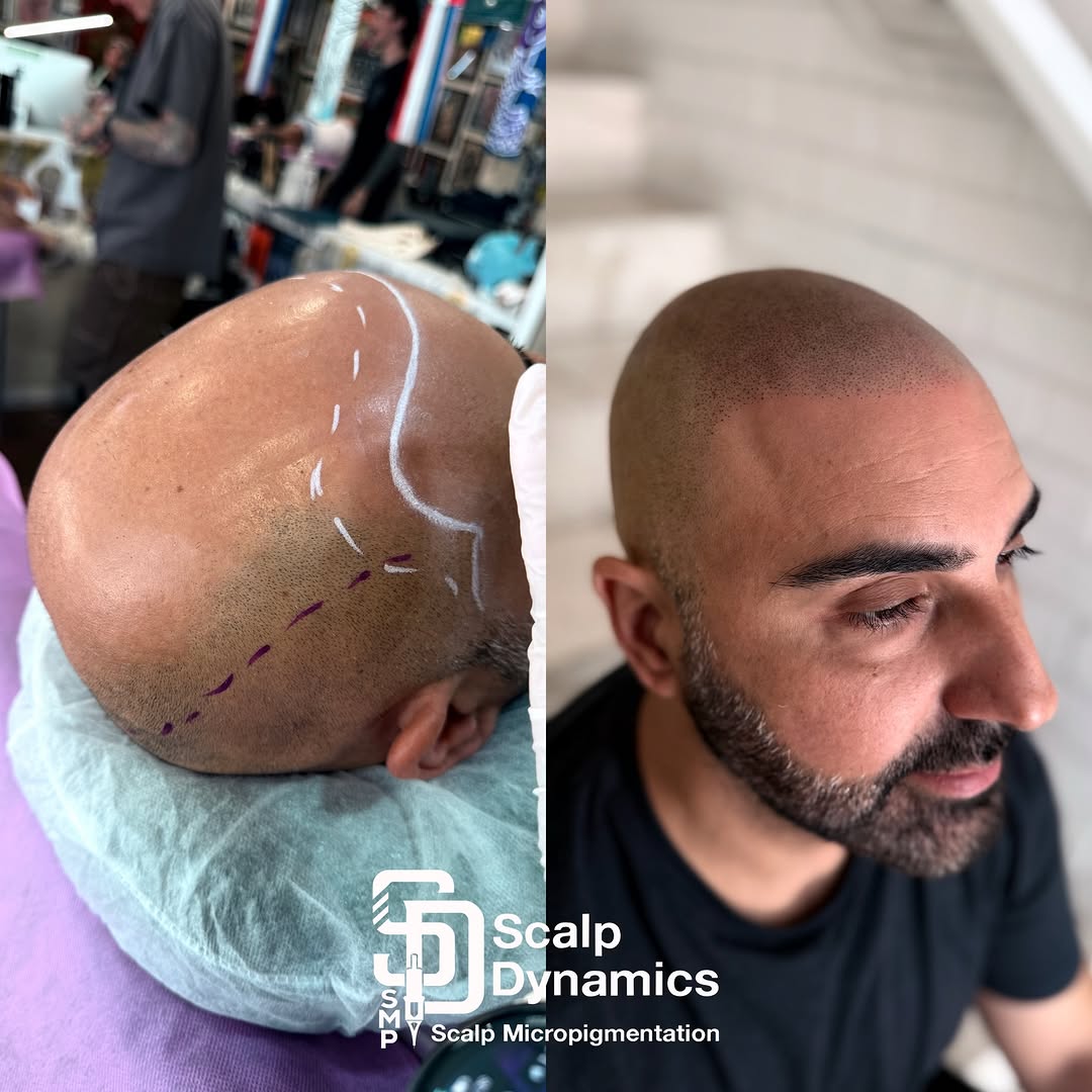 ScalpDynamics tattoo 2