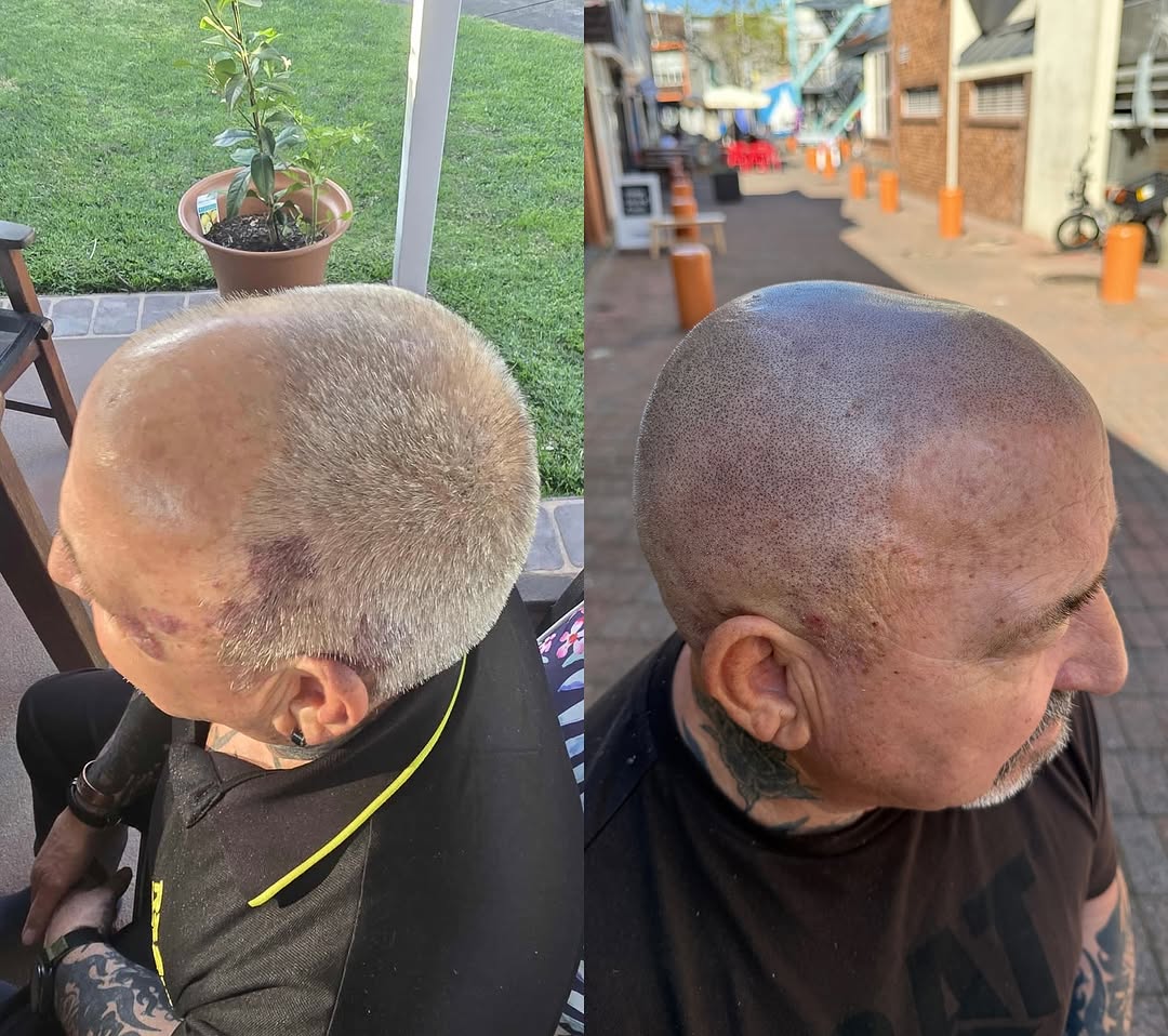 ScalpDynamics tattoo 20