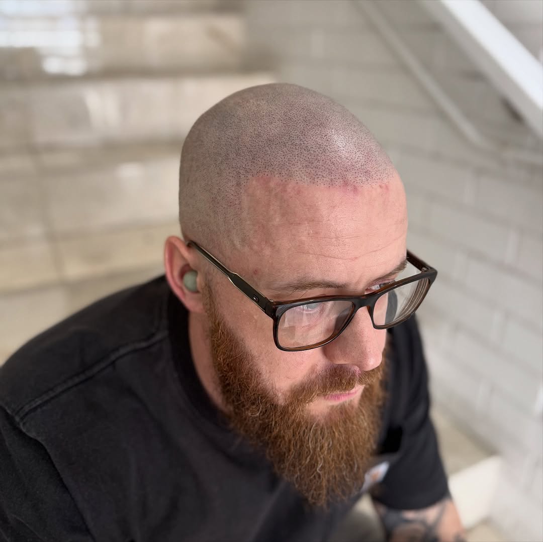 ScalpDynamics tattoo 6