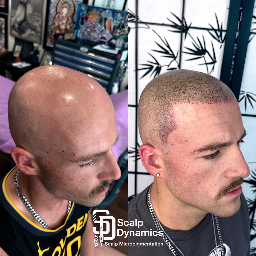 ScalpDynamics work 8