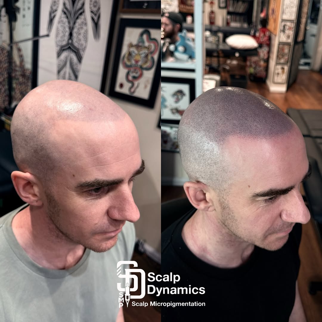 ScalpDynamics work 5